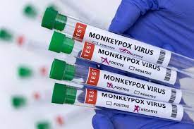 Monkeypox outbreak ‘containable’, confirms 131 cases outside Africa - WHO