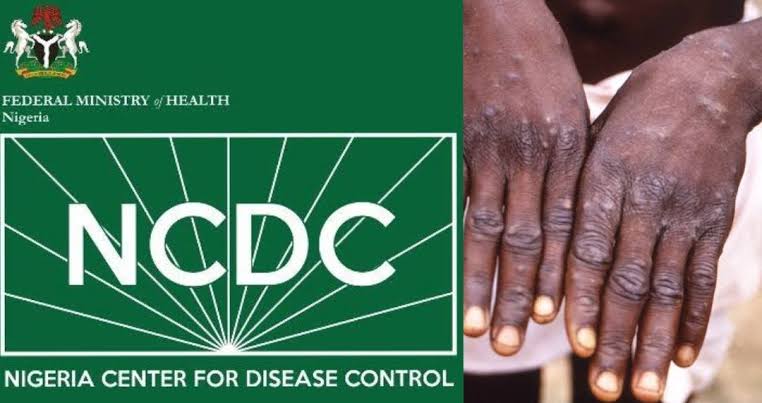 Monkeypox: Nigeria reports six cases, one death in May 2022